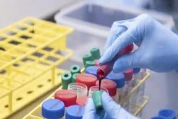 पुणे: आज से शुरू हो सकता है आक्सफोर्ड विश्वविद्यालय के टीके के दूसरे चरण का मानव परीक्षण