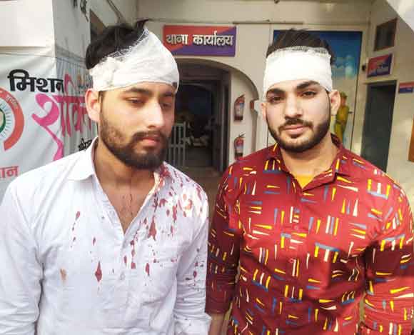 चार अज्ञात युवकों ने दुकानदारों को मारपीट कर किया घायल।