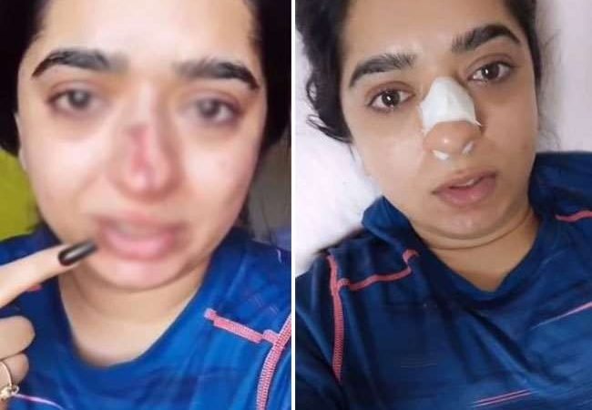 मॉडल पर हमला करने वाला Zomato का डिलीवरी ब्वॉय गिरफ्तार, ऑर्डर कैंसिल करने पर मारा था घूंसा