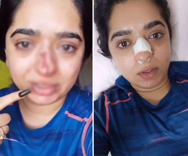 मॉडल पर हमला करने वाला Zomato का डिलीवरी ब्वॉय गिरफ्तार, ऑर्डर कैंसिल करने पर मारा था घूंसा