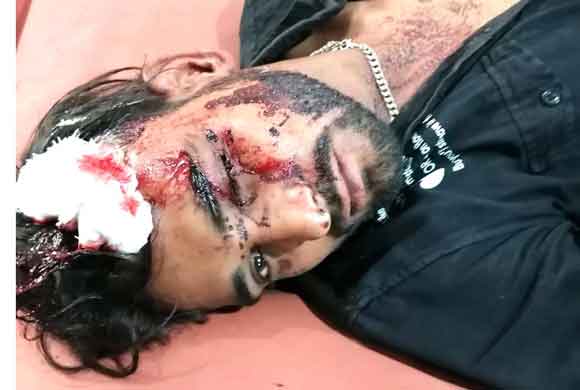 पैसे के लेनदेन में दो पक्षों में चले लाठी डंडे, महिला सहित छह घायल