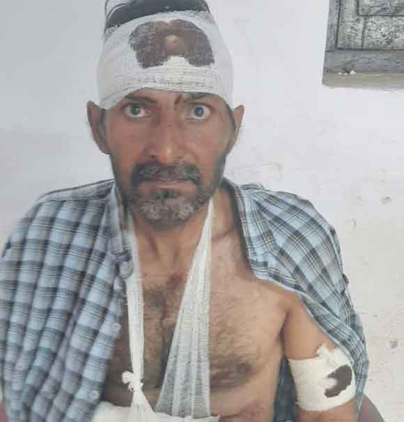 व्यक्ति को मारपीट कर किया घायल, थाने में दी तहरीर