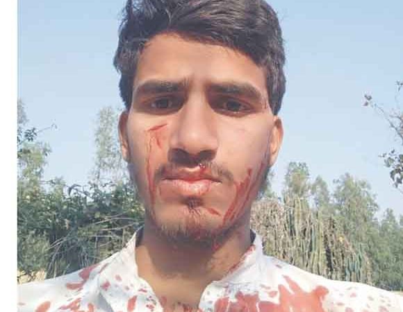 गुलदार के हमले से युवक घायल, भाइयों ने भागकर बचाई जान