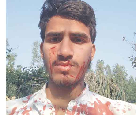 गुलदार के हमले से युवक घायल, भाइयों ने भागकर बचाई जान