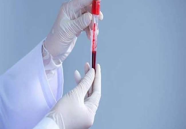 Govt COVID Treatment Guidelines: कोरोना पॉलिसी में बदलाव, संक्रमित मरीजों के लिए सरकार ने जारी की नई गाइडलाइंस