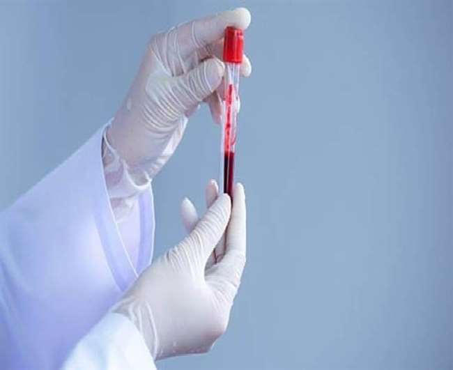 Govt COVID Treatment Guidelines: कोरोना पॉलिसी में बदलाव, संक्रमित मरीजों के लिए सरकार ने जारी की नई गाइडलाइंस