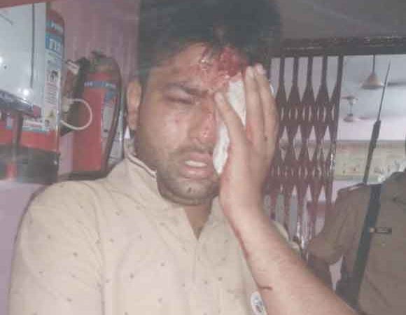बाइक सवार बदमाशों ने युवक पर किया फायर, गम्भीर घायल