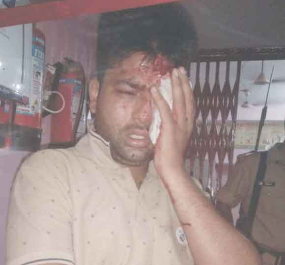 बाइक सवार बदमाशों ने युवक पर किया फायर, गम्भीर घायल