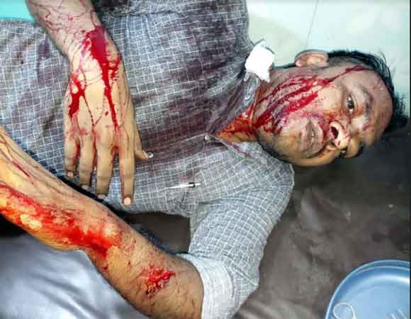 जमीनी रंजिश के चलते दो युवको पर जानलेवा हमला, एक की हालत गम्भीर
