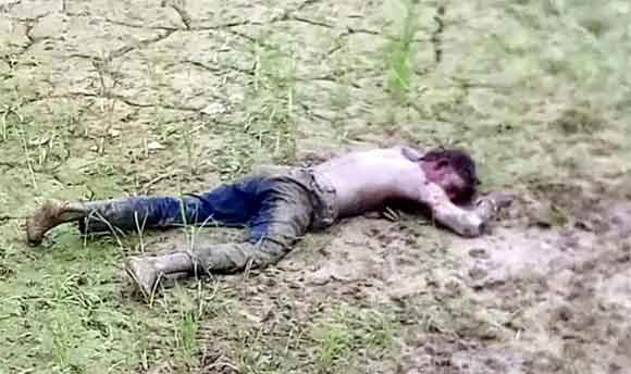 आदमखोर कुत्तों ने युवक पर हमला कर किया गंभीर रूप से घायल