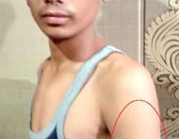 अध्यापक पर छात्र को बेदर्दी से पीटने का आरोप