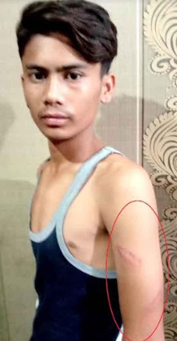 अध्यापक पर छात्र को बेदर्दी से पीटने का आरोप