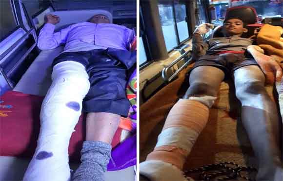 कार की चपेट आकर बाईक सवार पिता पुत्र घायल