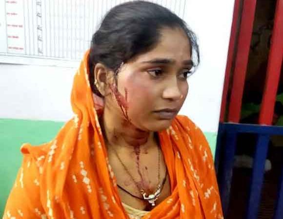 नशेडी पति ने पत्नी को मारपीट कर किया घायल