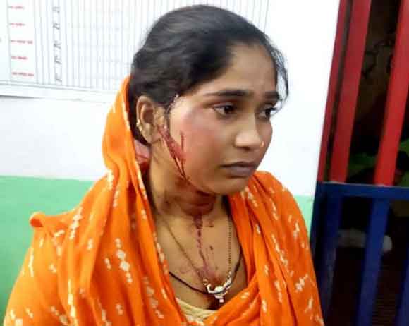 नशेडी पति ने पत्नी को मारपीट कर किया घायल