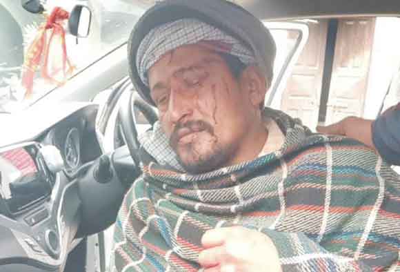 दर्जनों युवकों ने ढाबा स्वामी पर किया हमला, घायल