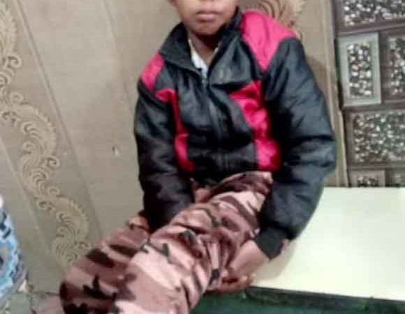 पालतू कुत्ते के नोच खाने से आठ वर्षीय बालक हुआ गंभीर घायल -परिजनो व पुलिस द्वारा उपचार के लिए सीएचसी में किया भर्ती