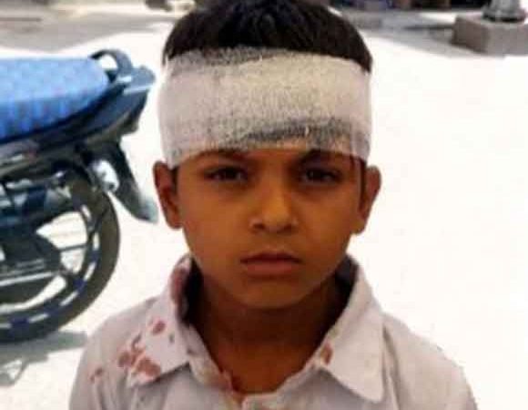 सात वर्षीय बालक के सिर में मारी ईंट, घायल,