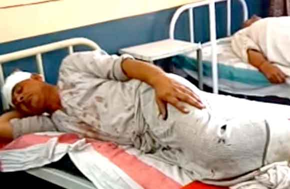 घेर का गेट लगाने को लेकर मारपीट, दो घायल