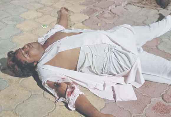अज्ञात हमलावरों ने नगर पंचायत कर्मचारी पर किया हमला, घायल