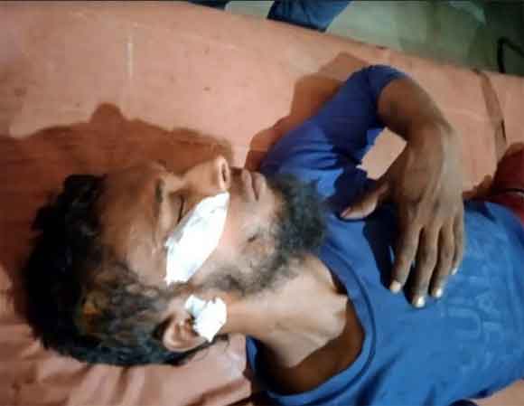 मामूली कहासुनी के चलते दो पक्षों में चले लाठी-डण्डे, एक युवक गम्भीर रूप से घायल
