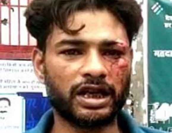 सोते समय पति पर पत्थर से हमला, घायल 