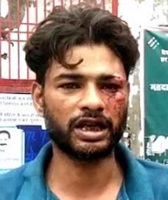 सोते समय पति पर पत्थर से हमला, घायल
