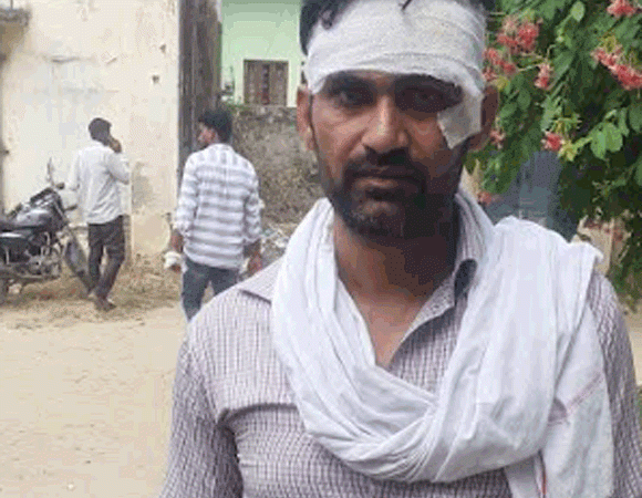 विद्युत चोरी सूचना पर जांच पर पंहुचे विद्युत कर्मचारी को पीटा