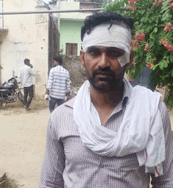 विद्युत चोरी सूचना पर जांच पर पंहुचे विद्युत कर्मचारी को पीटा