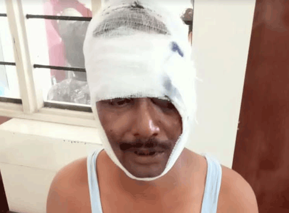 बाइकों की आमने-सामने की टक्कर में होमगार्ड गंभीर रूप से घायल,