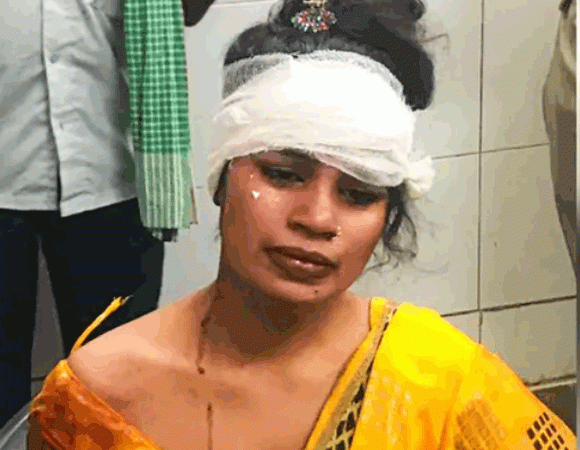 सिरफिरे पति की हैवानियत, पत्नी से अनबन हुई तो एक्सीडेंट के बहाने बुलाकर काटा कान