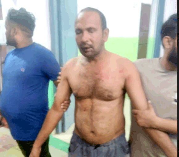आधा दर्जन लोगों ने एक व्यक्ति को लाठी-डण्डो से पीट कर किया घायल,