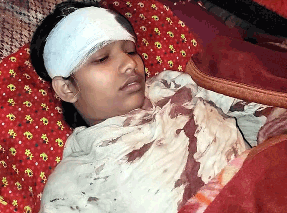 मामूली कहासुनी के चलते दो पक्षों में मारपीट, पथराव में किशोरी घायल