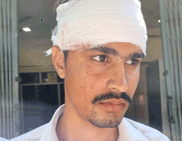 जेवी जैन कालेज में छात्रों में हुई मारपीट, एक घायल