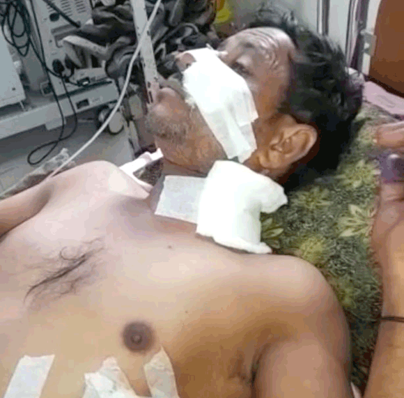 गाय चोरी करने बदमाशों ने किसान को चाकुओं से गोदकर किया गम्भीर रूप से घायल, फरार