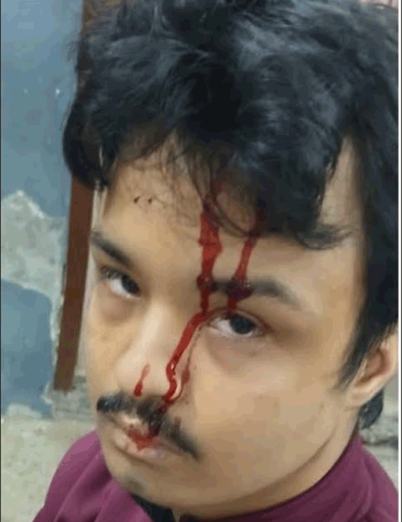 शाम ढलते ही अज्ञात बदमाशों ने चिकित्सक से सोने की चैन लूटी, विरोध करने पर बदमाशो ने युवक को घायल किया