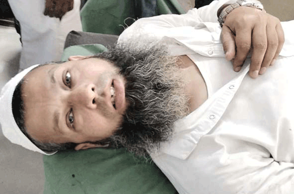 दिनदहाड़े ग्राम प्रधान पति पर हमला, गंभीर हालत में अस्पताल में भर्ती