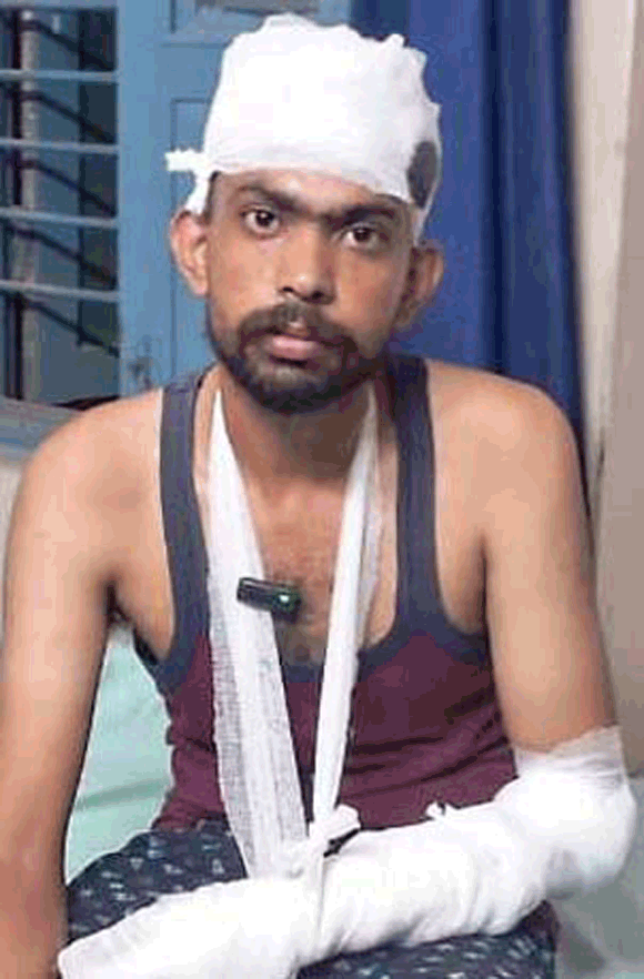 रास्ता न देने पर हुए विवाद में डॉक्टर पर हमला, जिला अस्पताल रेफर