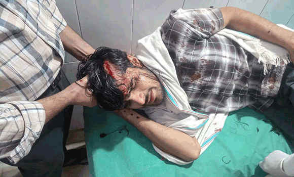 सहारनपुर: चकवाली गांव में कुरड़ी के खाते को लेकर खूनी संघर्ष, कई लोग घायल